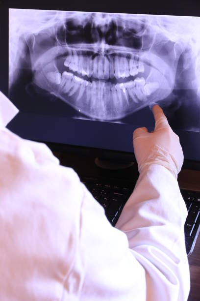 Best Emergency Root Canal Treatment in Pink, OK