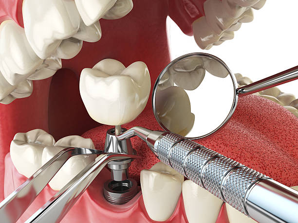 Best Broken or Cracked Tooth Emergency Dentist in Pink, OK